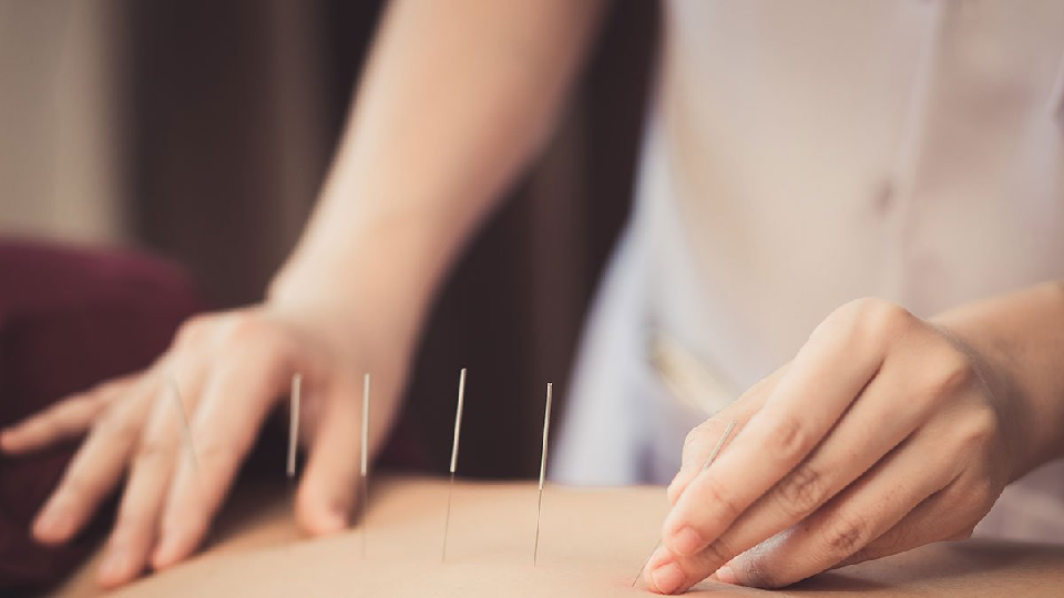 Acupuncture Healing, Best of Eastern and Western Medicine